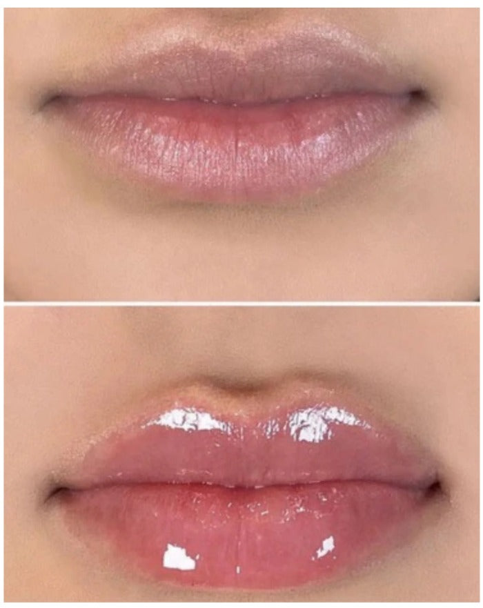Reedle Shot Lip Plumper - tratament pentru buze cu efect de volum și hidratare intensă, 4.3 g
